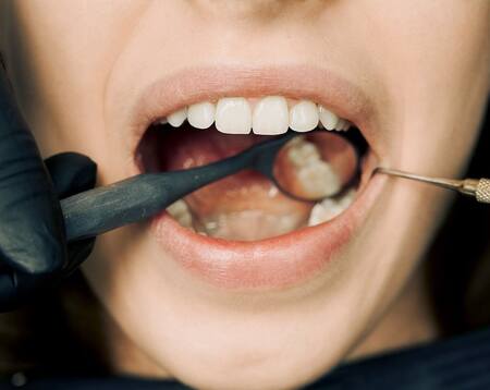 5. दांतों की समस्याएं: